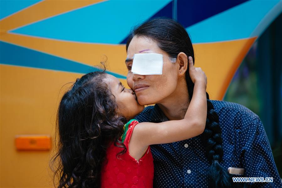 CAMBODIA-KAMPONG CHAM-CHINESE MEDICAL WORKERS-CATARACT-TREATMENT